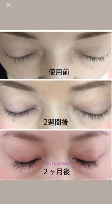 ラッシュアディクトプロ 新メニューです Neolive Mimo 北千住 東口店所属 小菅 みなみのマツエクデザイン ミニモ