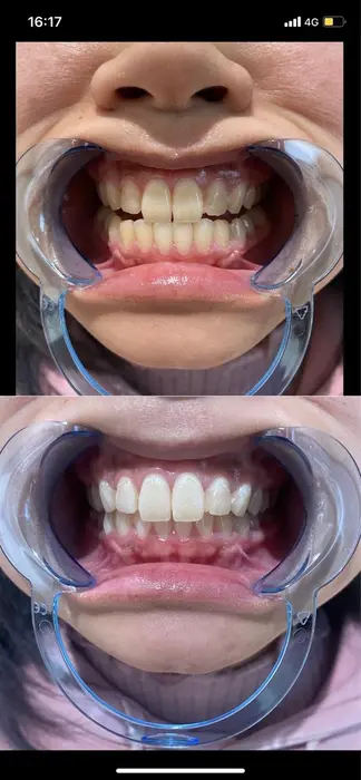 B St セルフホワイトニング エステティック経堂店所属 B St エステ ホワイトニング経堂店のエステ リラク カタログ ミニモ