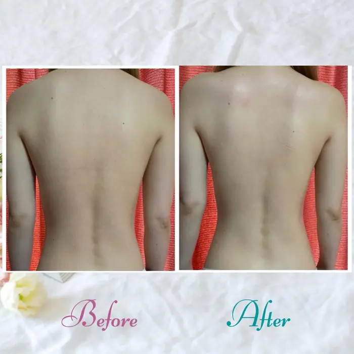 背中をしっかりほすぐことで 肩のラインがこんなに美しくなります 背中や肩のマッサージは特にこだわっ くつろぎアロマ シャルビトン所属 吹田 夢唯のエステ リラクカタログ ミニモ