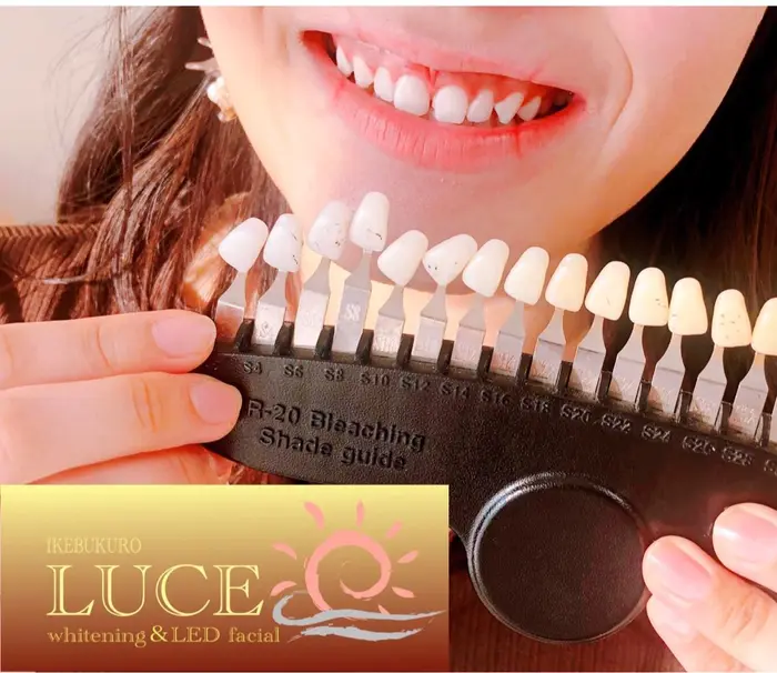 いつもありがとうございます 一気に真っ白プランのご利用です ウェディングや もちろんどなたでもご利 歯のホワイトニング Ledフェイシャルサロン Luce ルーチェ所属 Whitening Luce 池袋店のヘアカタログ ミニモ