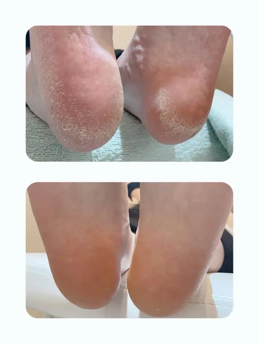 ガサガサかかとが一回でツルツル ふわふわの足裏に ベルトリージェイ福島店所属 ベルトリージェイ 中田奈緒のネイルデザイン ミニモ