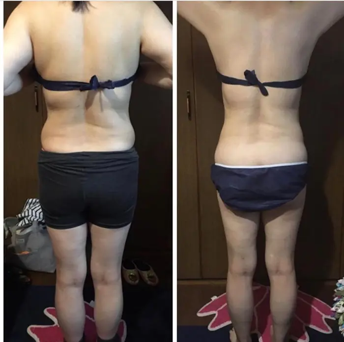 モティーブジェル痩身 上半身のみ4回でこの結果 マッサージしながら塗り込むので 痛みは全くあり エステティックサロン華々所属 福島 かおりのエステ リラクカタログ ミニモ