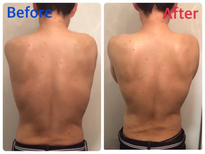 セルライトケア一回の施術です Salon De Musk所属 Salon De Muskのエステ リラクカタログ ミニモ