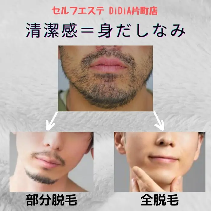 ヒゲだけでもお顔の印象が変わります セルフ脱毛ならヒゲの部分残しも可能 自分でするから細かいデザ セルフエステティックスタジオdidia片町店所属 セルフエステ Didia片町店のエステ リラクカタログ ミニモ
