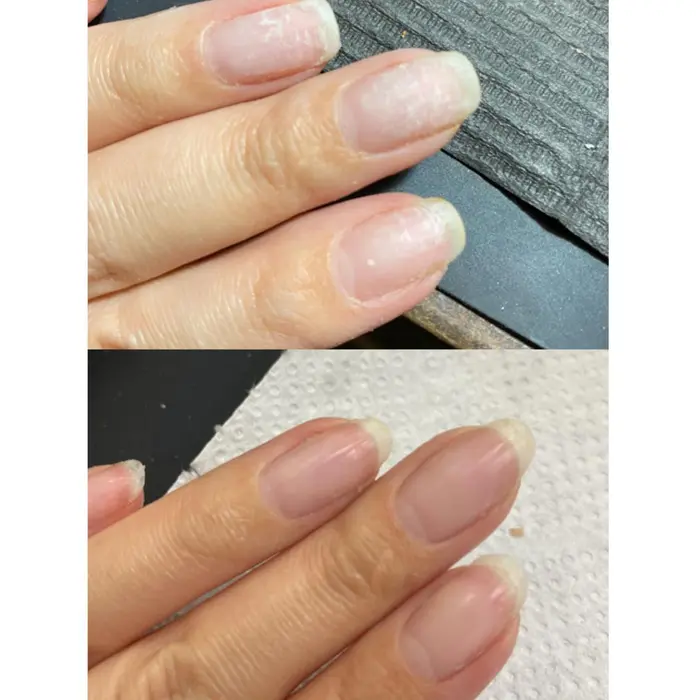 ダメージネイルの補修モニターさん募集中です ジェルやアクリルで爪が痛み Nailをお休みされてい 美爪屋 Mincono所属 吉祥寺 美爪屋minconoのネイルデザイン ミニモ