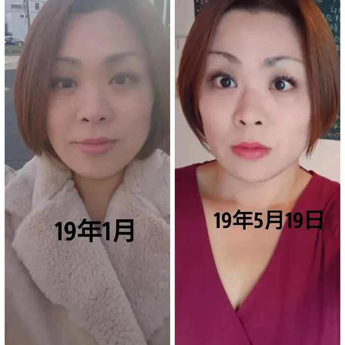 60分小顔コルギ週1やりました 小顔コルギsalonchachapoco所属 仙頭 礼菜のエステ リラクカタログ ミニモ 60分小顔コルギ週1やりました 小顔コルギsalonchachapoco所属 仙頭 礼菜のエステ リラクカタログ ミニモ
