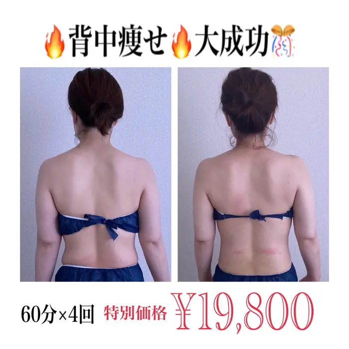 肩 肩甲骨まわり 腰に盛っていたお肉がスッキリ 二の腕も引き締まりました デトックス美容専門サロンｐｅｏｎｙ所属 デトックス美容専門 サロンｐｅｏｎｙのエステ リラクカタログ ミニモ