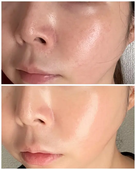 どんなお肌にも大きな変化を感じさせてくれる5days！乾燥しがちなお肌に?...