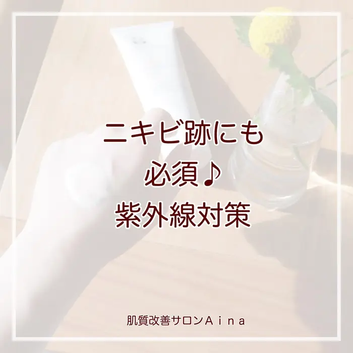 ニキビ跡にも必須紫外線対策 やっと梅雨明け 夏本番 暑いのは苦手ですが 夏は大好き ニキビ ニキビ跡専門サロンａｉｎａ所属 ニキビ改善サロン 益子早百合のエステ リラクカタログ ミニモ