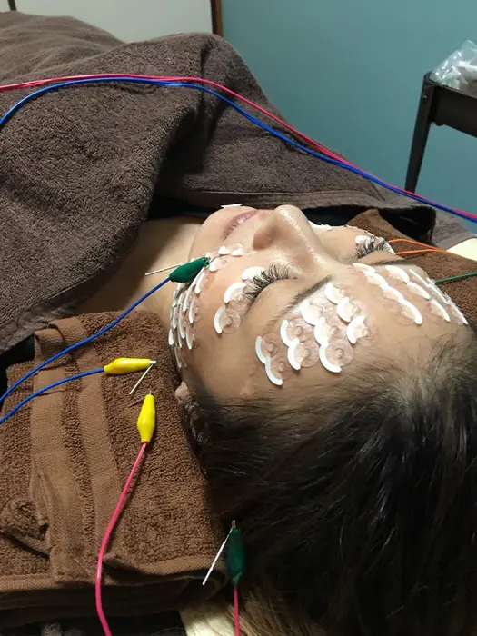 鍼の苦手な方でも特殊なシール使って治療します はち鍼灸院所属 田岡 章吾のヘアカタログ ミニモ