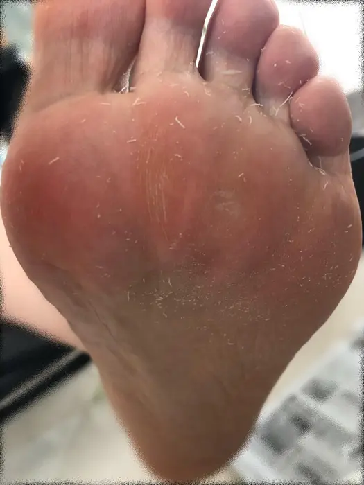 足裏角質除去 Nail Salon F 所属 ｋ ｍｏｍｏｋｏのネイルデザイン ミニモ