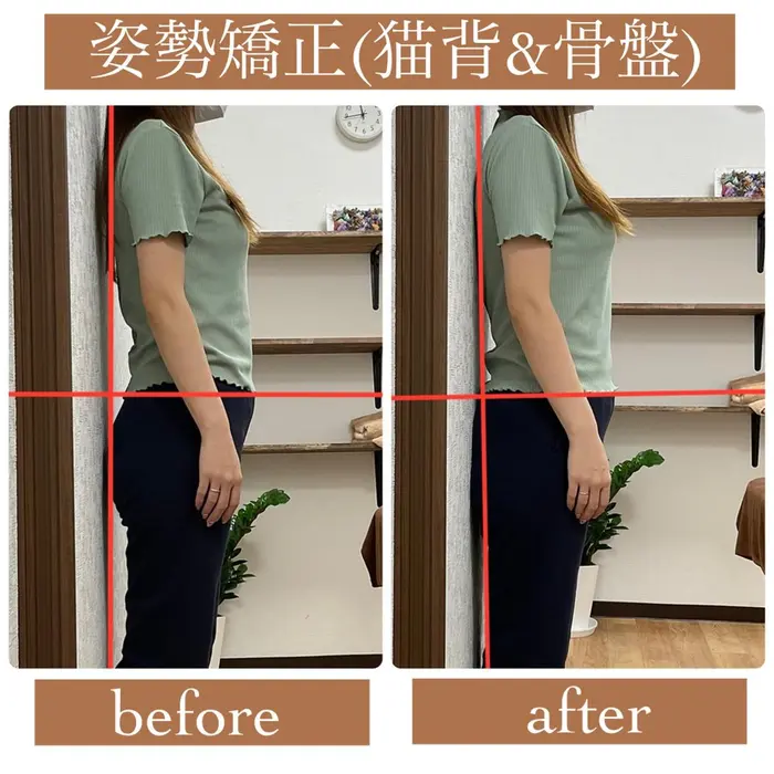 【姿勢矯正】

ヤラセ一切なし
たった40分の施術でここまで改善されます

...