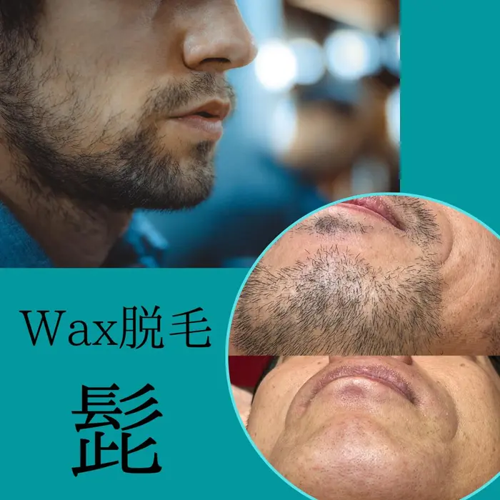 ヒゲの Wax脱毛 痛いけど 綺麗 光脱毛との併用がお勧め Salon De Appeal所属 Salon De Appealカナのエステ リラクカタログ ミニモ ヒゲの Wax脱毛 痛いけど 綺麗 光脱毛との併用がお勧め Salon De Appeal所属 Salon De Appealカナのエステ リラクカタログ ミニモ