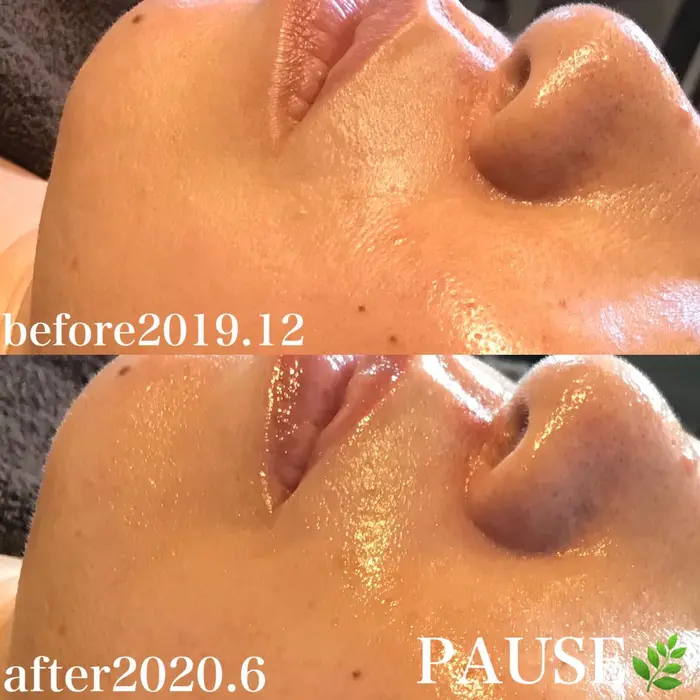 自分のお肌を育てる 無添加なのに結果が期待できる リアボーテ クレアスキン化粧品 アロマ エステ Pause ポーズ 所属 浜野 恵美のエステ リラクカタログ ミニモ