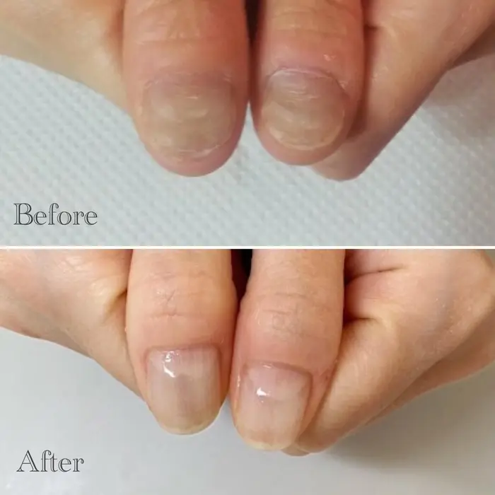 爪のでこぼこ なくなりました ネイルサロンアリューム所属 ネイルサロン アリュームのネイルデザイン ミニモ