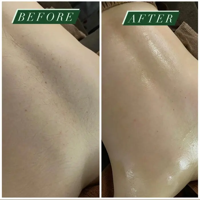 一度でこの変化 夏に向けて背中のケアしませんか まだ間に合います 当日相談してメニューを決め Azzurro所属 玲奈 メンズも対応のエステ リラクカタログ ミニモ