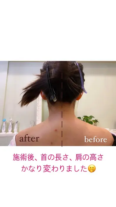 肩の高さ 首の長さ に変化 Il Fait Beau Shizuna所属 サロンshizunaの エステ リラクカタログ ミニモ