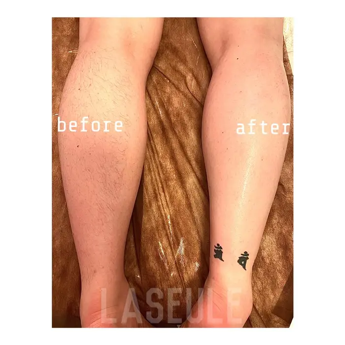 Men Sw脱毛でその日からツルツル ショーパンの脚も清潔感up Wax脱毛なら光脱毛では Privatesalon Laseule所属 Laseule Yuiのエステ リラクカタログ ミニモ