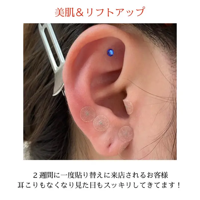 美肌のツボも同時にやっていくとますますお顔が綺麗になります Setsalon Churaku所属 浜比嘉 綾のヘアカタログ ミニモ