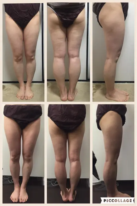 脚やせ 目指せカモシカ脚 Romantic Diva所属 初芝 恵梨菜のエステ リラクカタログ ミニモ