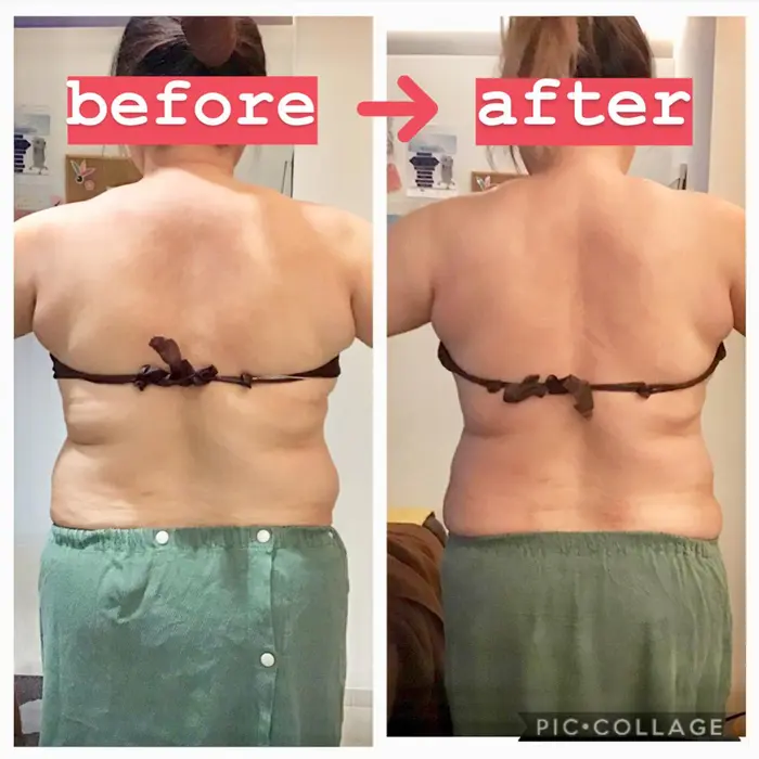 背面筋膜リリース セルケア 上半身のサイズダウンお任せください エステティック Rayvis 川崎店所属 Rayvis川崎 門のエステ リラクカタログ ミニモ