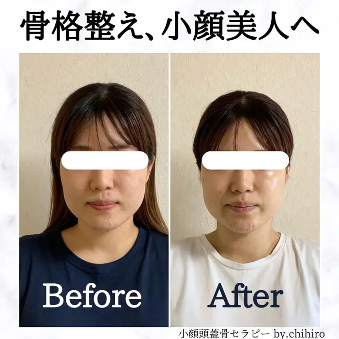 骨格から整える小顔矯正 小顔 頭骨矯正 Cherish 所属 小顔ソムリエ 會野 千尋のエステ リラクカタログ ミニモ