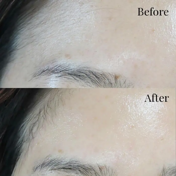 糸脱毛で安全に顔のうぶ毛を除去し肌の色がワントーンアップで艶肌ゲットできます Glow所属 中村 淳子のヘアカタログ ミニモ