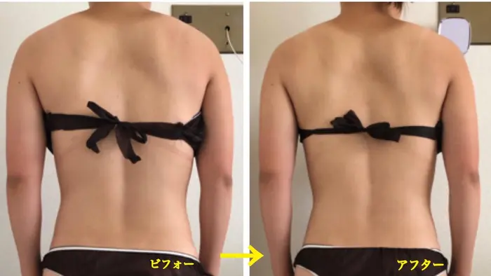 背中のラインづくり Ideal S アイディール エス所属 山本 ちえみのエステ リラクカタログ ミニモ