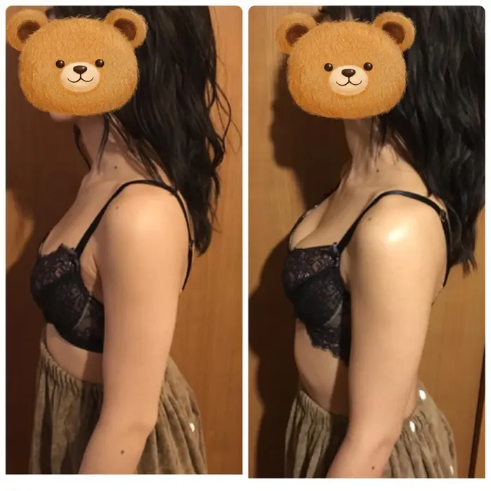 バストだけじゃなく、猫背も強制できます
姿勢が良くなるとバストアップ...