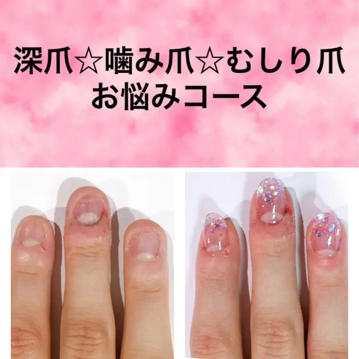 自爪が伸ばせないかた必見です マナビス ボワール所属 マナビス ボワールのネイルデザイン ミニモ