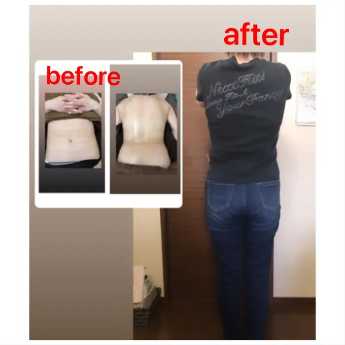 痩身エステ Befoe Aftfr 短期間の結果 ウエスト58cm台に Salon Du Chocolat所属 Chocolat Himeのネイルデザイン ミニモ