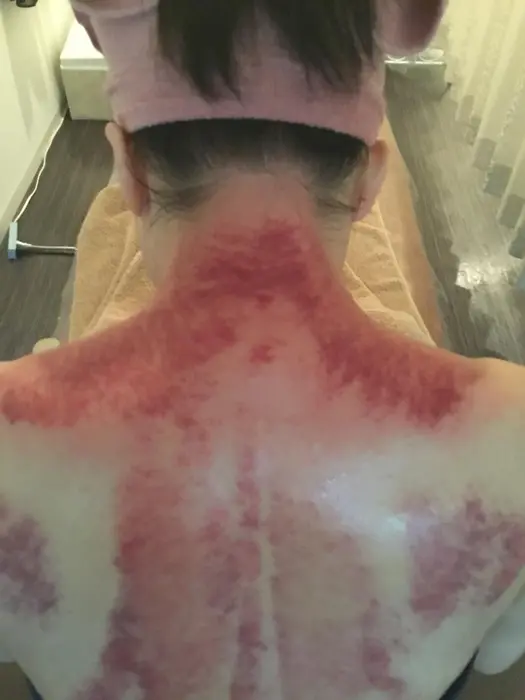 ボディカッサ 体の凝りや疲れが多いと色が濃く出ます Salon De Soin所属 コルギセラピスト まきの エステ リラクカタログ ミニモ