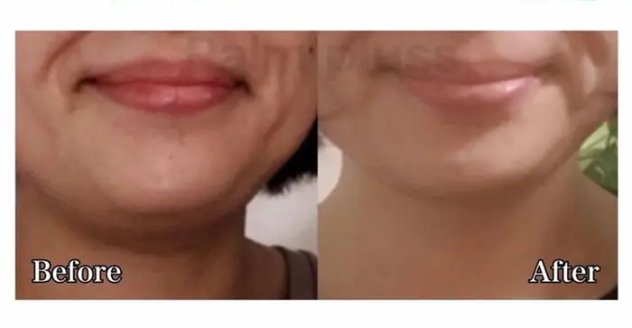 二重あごは痩せているとか太っているというのは実は関係ありません 二重あごの原因はお顔のたるみだけ フェイシャル デコルテ専門 Palm Pluss所属 Palm Pluss パームプラス のエステ リラクカタログ ミニモ