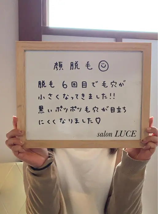 お顔脱毛のご感想毛が生えているとくすみや毛穴の広がりの原因にもなりますが 脱毛してからお友達にも気 Salon Luce サロンルーチェ所属 Salon Luceのヘアカタログ ミニモ