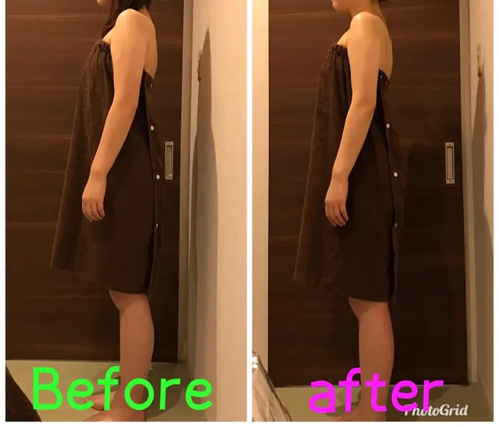 4月に挙式を控えてみえるお客様 二の腕スッキリしてきてます B Cure所属 内田 真子のエステ リラクカタログ ミニモ