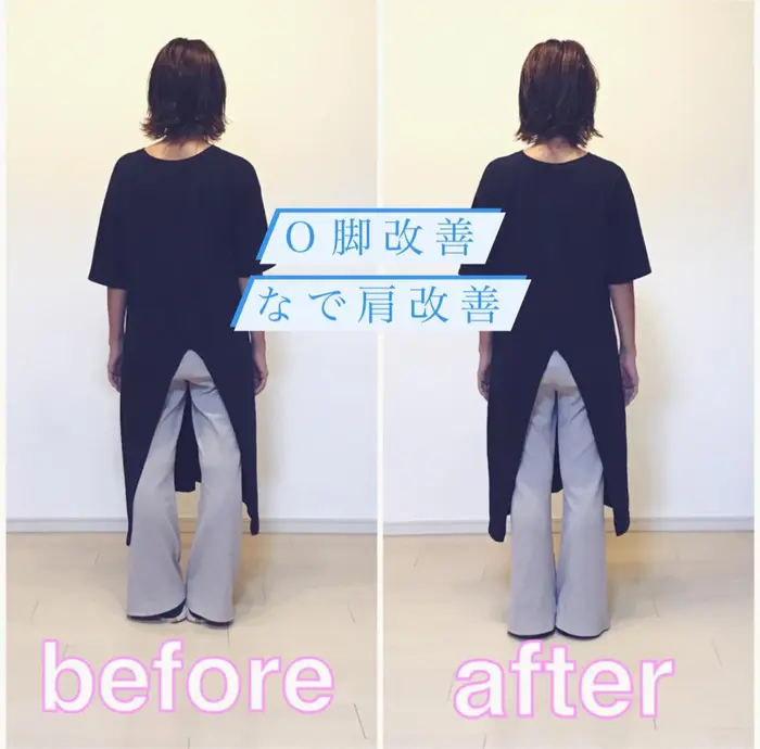 o脚矯正で脚のラインが綺麗になりました 骨盤矯正もしたので 太ももが細くなっています Total Body Care Salon Sunny所属 整体 筋膜オイル 小顔矯正 心斎橋 のエステ リラクカタログ ミニモ