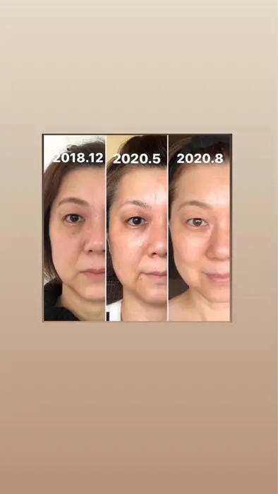 リバースエイジング Kirarie所属 片山 理恵のエステ リラクカタログ ミニモ