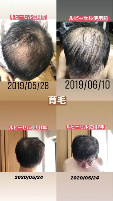 ヒト幹細胞培養液導入では お顔メインのケアと育毛メインのケアをお選びいただけます Parafuse 新潟駅前店所属 Parafuse 新潟駅前店のエステ リラクカタログ ミニモ