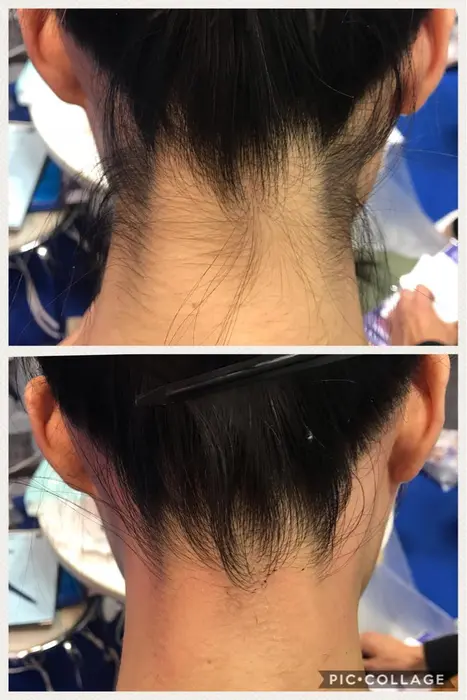 自分で見えないから気付かないですが 無処理は結構ムダ毛が多いs ロ Lll ワックス脱毛で綺麗に Chouette所属 シュエット サヤカのエステ リラクカタログ ミニモ