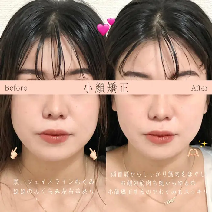 眉毛パーマと小顔矯正の同時施術お顔のバランスを整えながら眉毛を整えるので 仕上がりに自信あり Ivy Studio 13所属 美眉と美肌のサロン Ivy Studioのアイブロウ 眉毛カタログ ミニモ