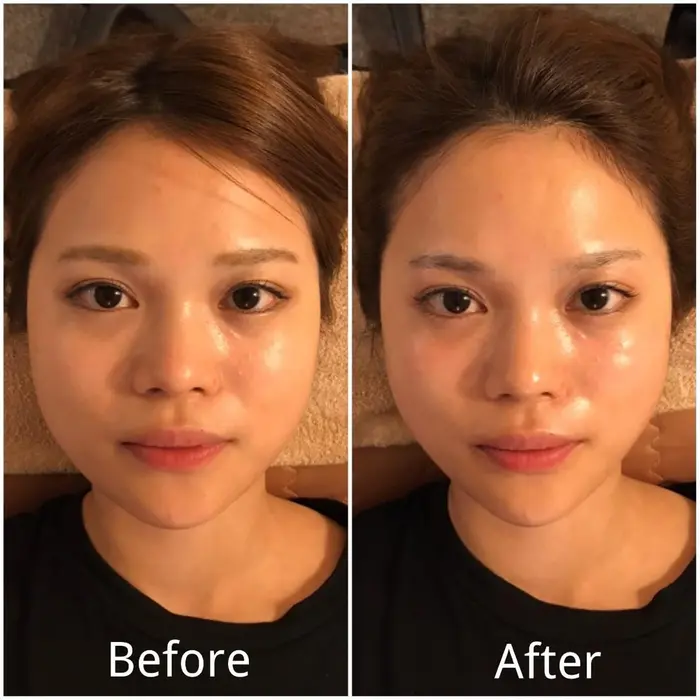 超小顔と毛穴レス肌 毛穴の汚れ 毛穴の開きを徹底改善する造顔コルギ サロンドミピマム所属 Lio 小顔 の世界大会受賞店のエステ リラクカタログ ミニモ