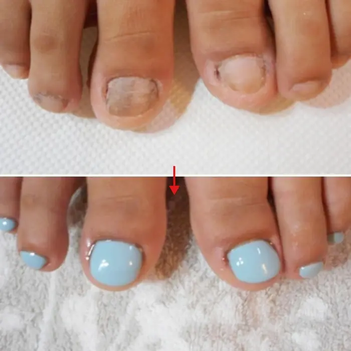 爪のでこぼこもなおします ネイルサロンアリューム所属 ネイルサロン アリュームのネイルデザイン ミニモ