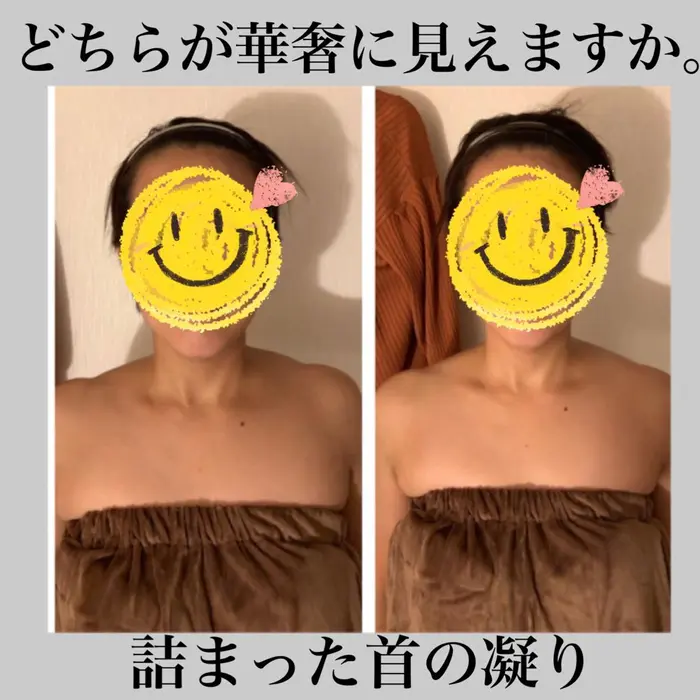 辛い肩こりも華奢に変身 シェイプラボ所属 柏 小顔専門サロン 中野のエステ リラクカタログ ミニモ