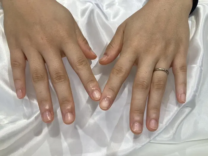 ハンドケア天川処理　ウォーターケア