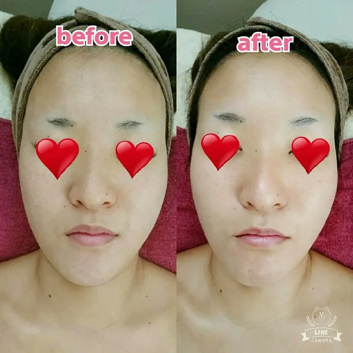 1回のこの効果 お肌がワントーン明るくなり フェイスライン ほうれい線がスッキリします L Avenir所属 L Avenir Yukaのマツエクデザイン ミニモ