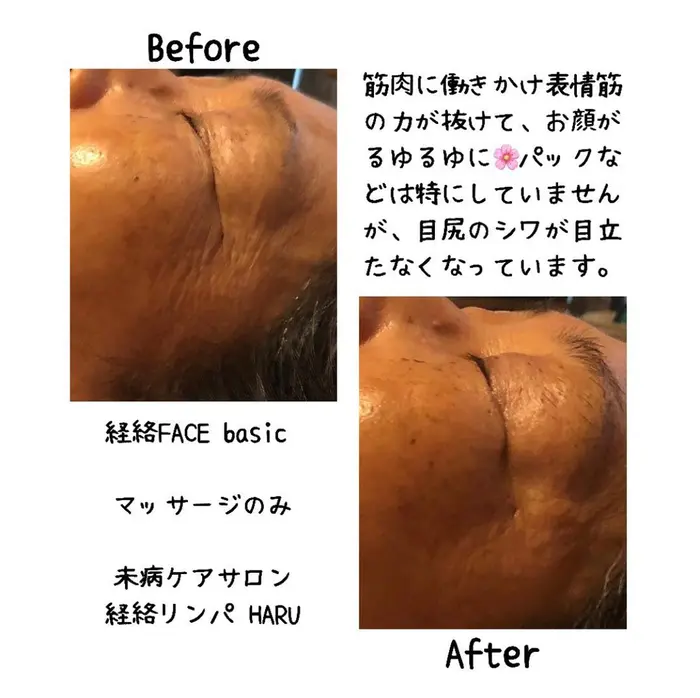 パックや美容液が無くても 筋肉が元の位置に戻ることでシワが薄くなるんです 未病ケアサロン 経絡リンパ Haru所属 加藤 千春のエステ リラクカタログ 20210923133104 ミニモ