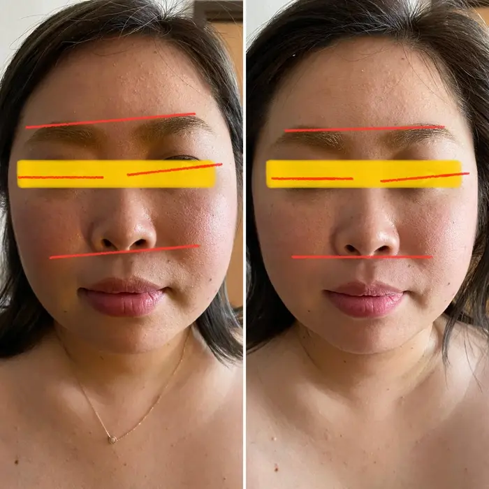 顔の歪みを優しく触れて 優しく揺らして整えていきます フェイスラインもスッキリ 継続して更に整 Antime 所属 福田 杏奈のエステ リラクカタログ ミニモ