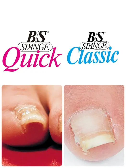 巻き爪でお困りの方 ドイツ式巻き爪ケアのb Sブレイズ取扱店 お気軽にぜひご相談下さいね Micky Nail所属 Micky Nail Chikushinoのネイルデザイン ミニモ 巻き爪でお困りの方 ドイツ式巻き爪ケアのb Sブレイズ取扱店 お気軽にぜひご相談下さいね Micky Nail所属 Micky Nail Chikushinoのネイルデザイン ミニモ