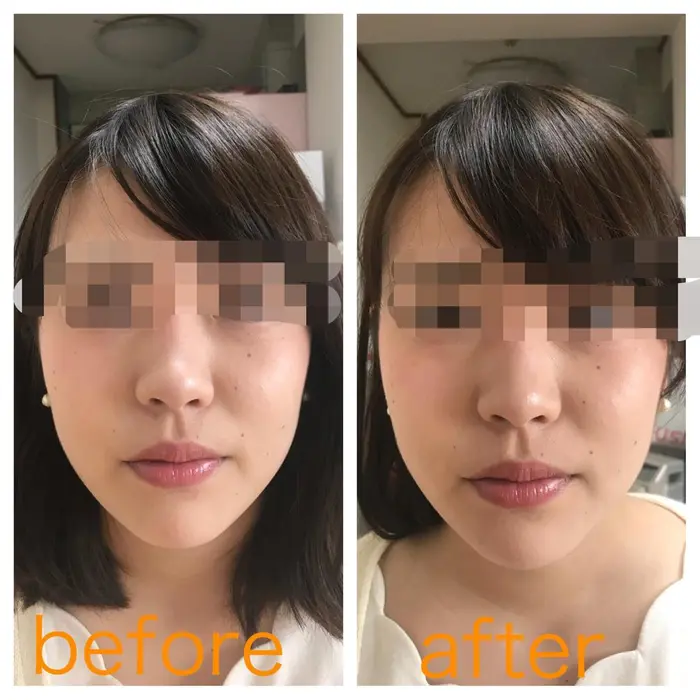 フェイスラインがスッキリ アイビー化粧品 営業所所属 辰巳 陽子のエステ リラクカタログ ミニモ