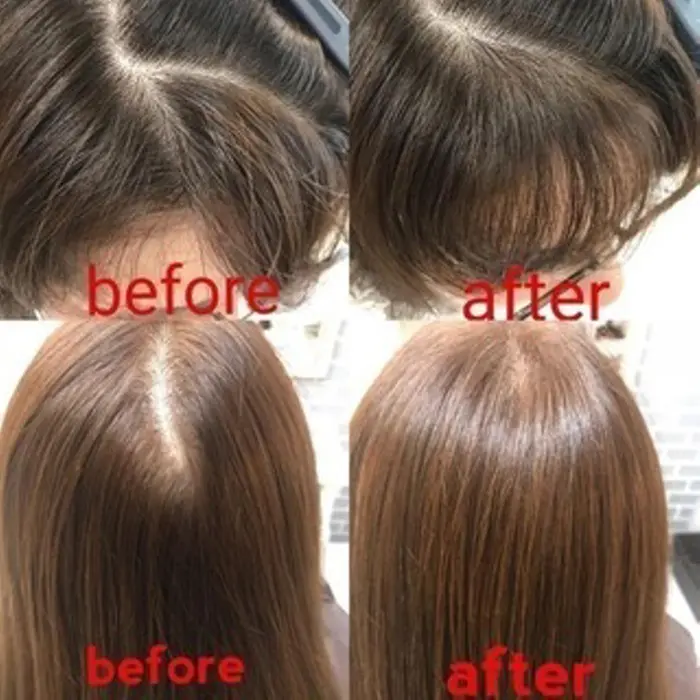 ヘアリセッター施術後のbeforeとafter 生え際の絡みを根元改善するだけで悩みの原因が解消 ｌｏｒｅ所属 話題の技術 タカハシ ケントのヘアカタログ ミニモ